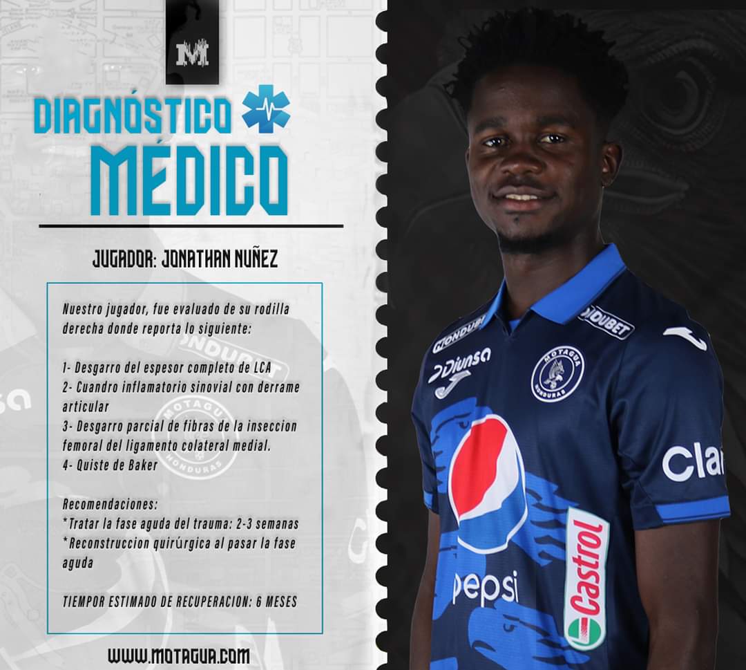 De esta forma, el cuerpo médico de Motagua anuncia la gravedad de la lesión del mediocampista Jonathan Núñez.