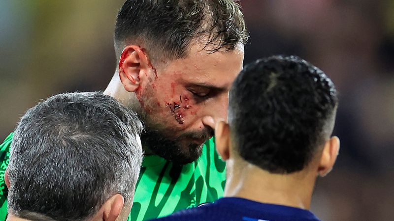 El portero italiano del Paris Saint-Germain, Gianluigi Donnarumma, recibe asistencia médica después de sufrir una lesión durante el partido contra Mónaco.